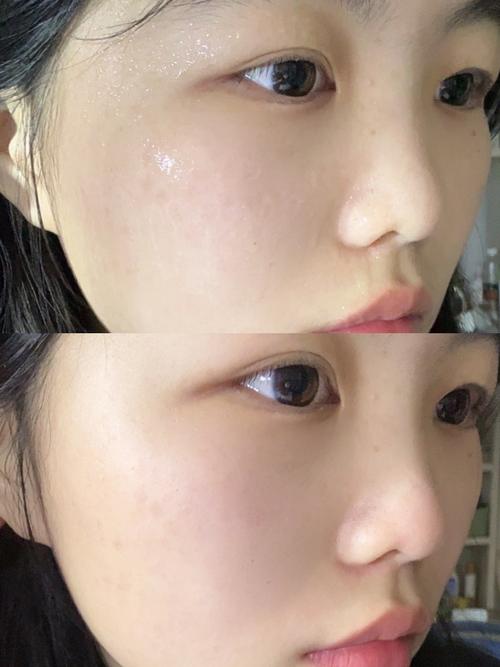 丝芙菲美白抗皱精华正品，黄皮提亮抗皱敏感肌可用精华