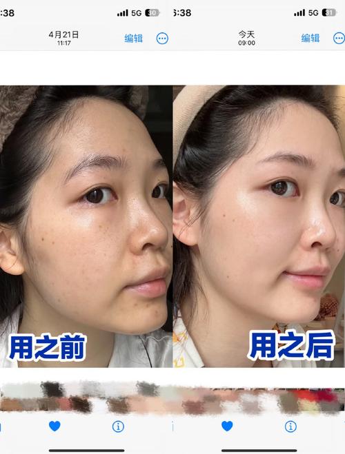 痘印色斑消了又长，丝芙菲雪肌抗皱精华霜=淡斑+淡印+抗皱多效面霜