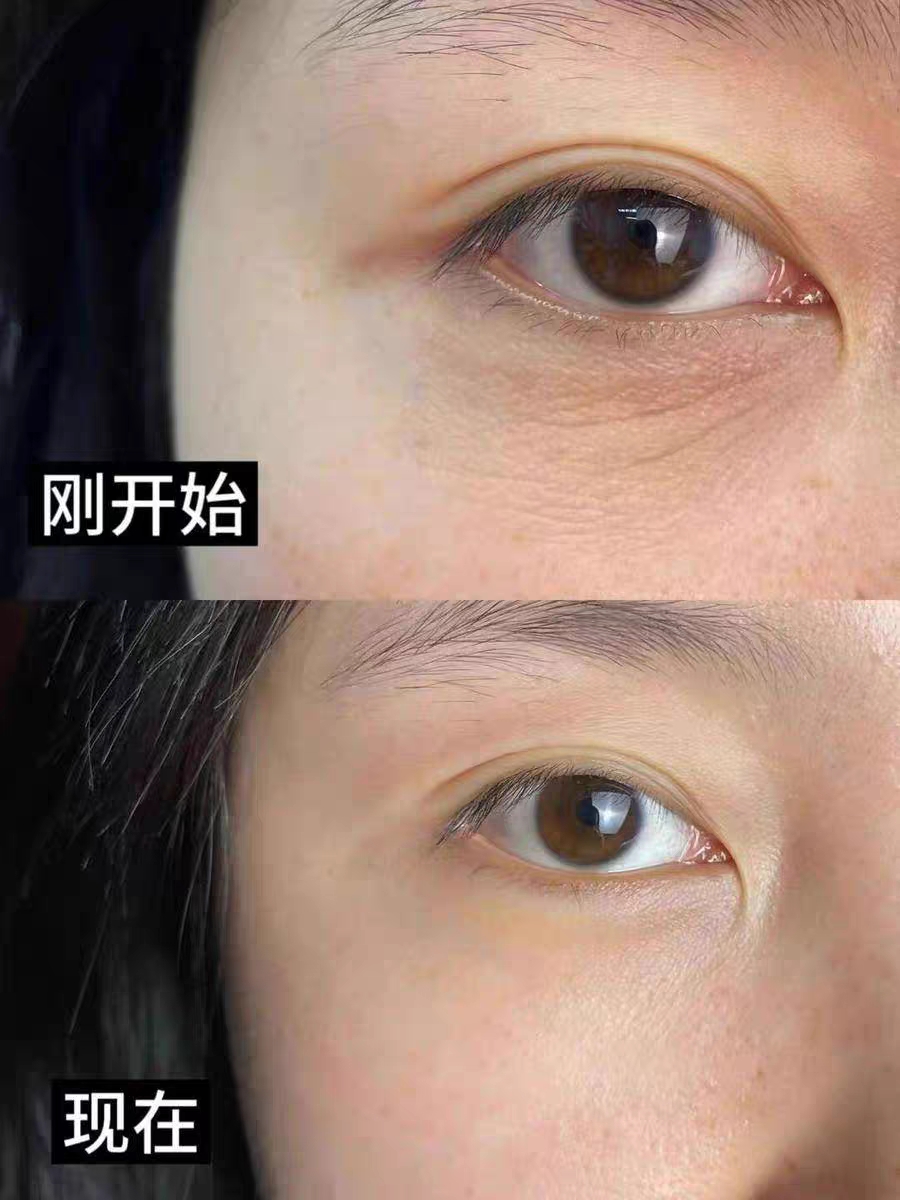 垮脸回春神器!丝芙菲塑颜抗皱紧致换肤套盒淡纹紧轮廓真的猛